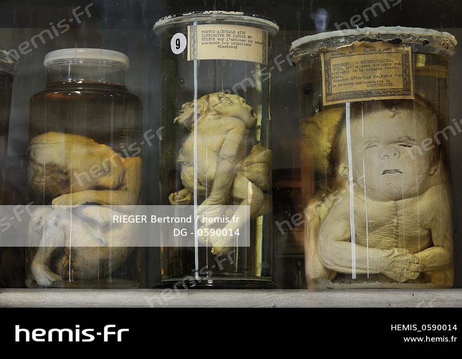 Hemis France Herault Montpellier Centre Historique Faculte Medecine Musee Anatomie Foetus Collection Teratologie